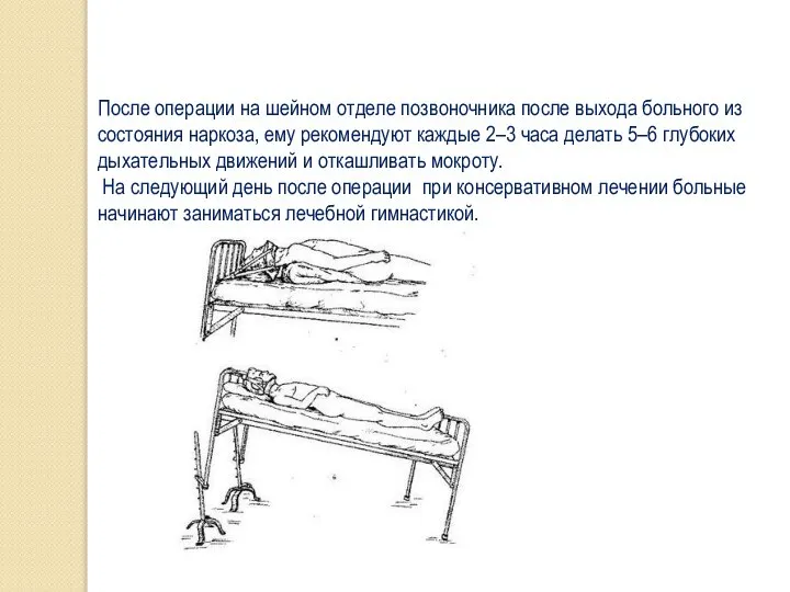 После операции на шейном отделе позвоночника после выхода больного из состояния