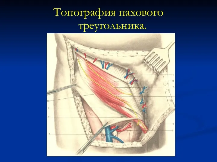 Топография пахового треугольника.