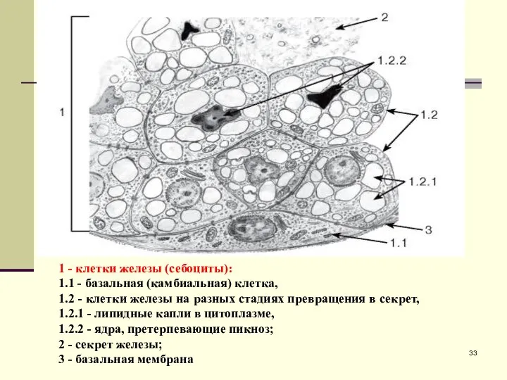 1 - клетки железы (себоциты): 1.1 - базальная (камбиальная) клетка, 1.2