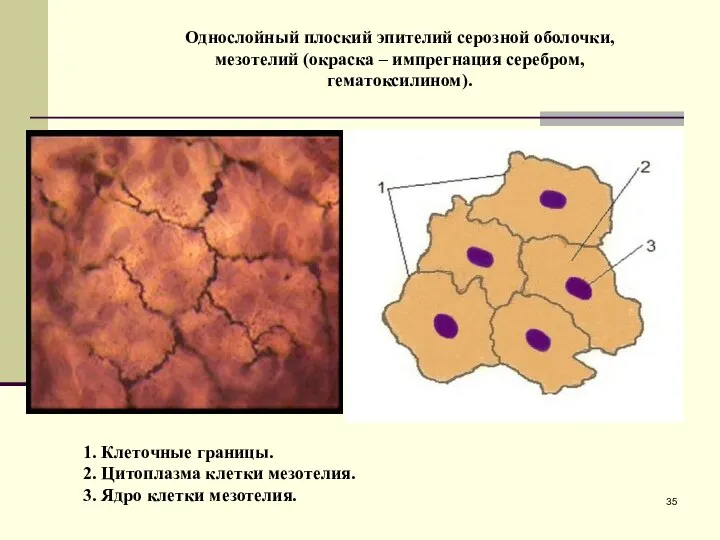 Однослойный плоский эпителий серозной оболочки, мезотелий (окраска – импрегнация серебром, гематоксилином).