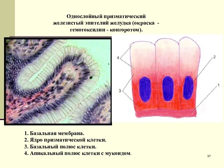 Однослойный призматический железистый эпителий желудка (окраска - гемотоксилин - конгоротом). 1.