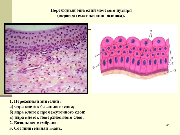 Переходный эпителий мочевого пузыря (окраска гематоксилин-эозином). 1. Переходный эпителий: а) ядра