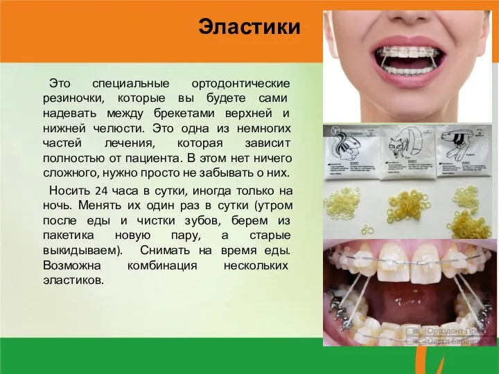 Эластики Это специальные ортодонтические резиночки, которые вы будете сами надевать между