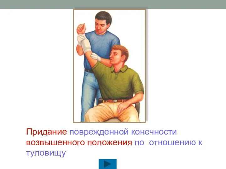 Придание поврежденной конечности возвышенного положения по отношению к туловищу