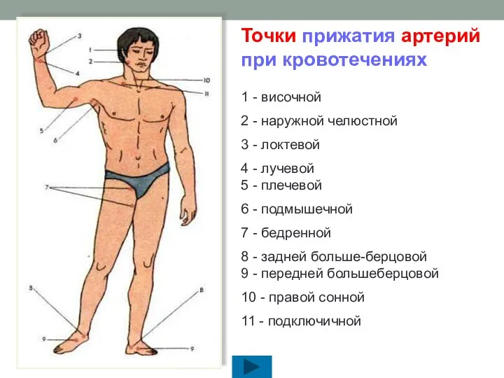 Точки прижатия артерий при кровотечениях 1 - височной 2 - наружной