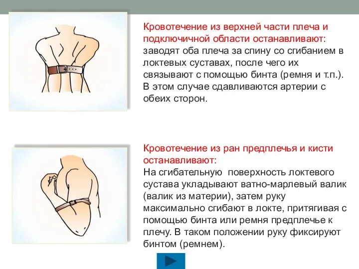 Кровотечение из верхней части плеча и подключичной области останавливают: заводят оба