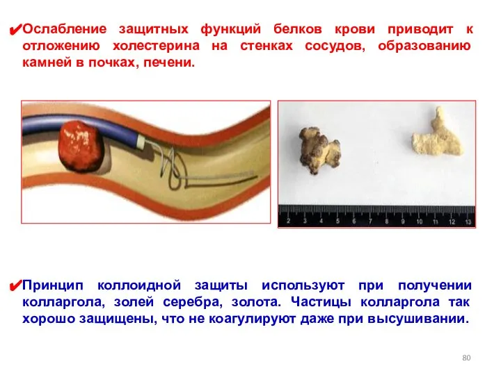 Ослабление защитных функций белков крови приводит к отложению холестерина на стенках