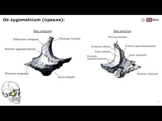 Os zygomaticum (правая): Вид снаружи Вид изнутри