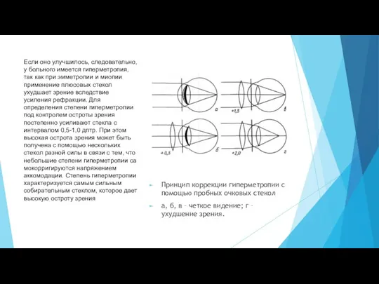 Принцип коррекции гиперметропии с помощью пробных очковых стекол а, б, в