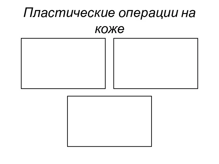 Пластические операции на коже Пластика местными тканями Пластика кожным лоскутом на