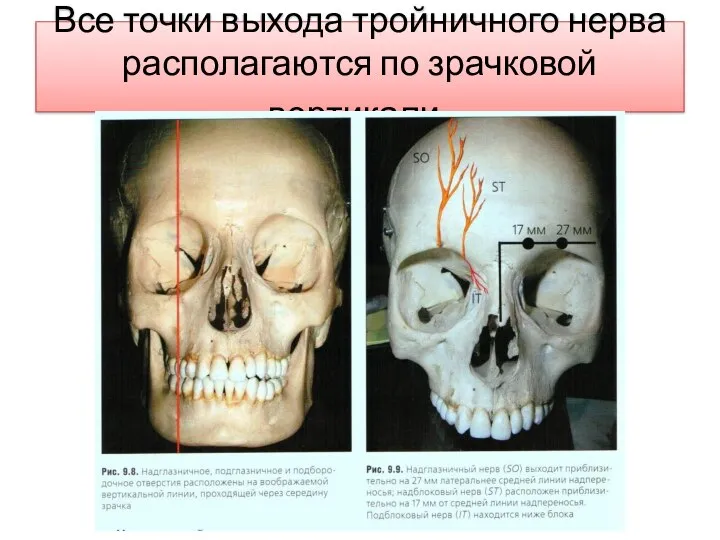 Все точки выхода тройничного нерва располагаются по зрачковой вертикали.