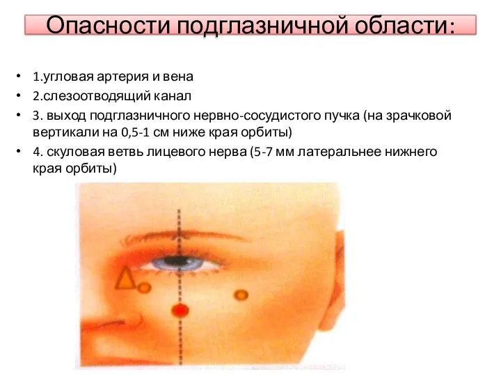 Опасности подглазничной области: 1.угловая артерия и вена 2.слезоотводящий канал 3. выход