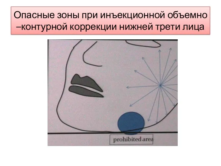 Опасные зоны при инъекционной объемно –контурной коррекции нижней трети лица