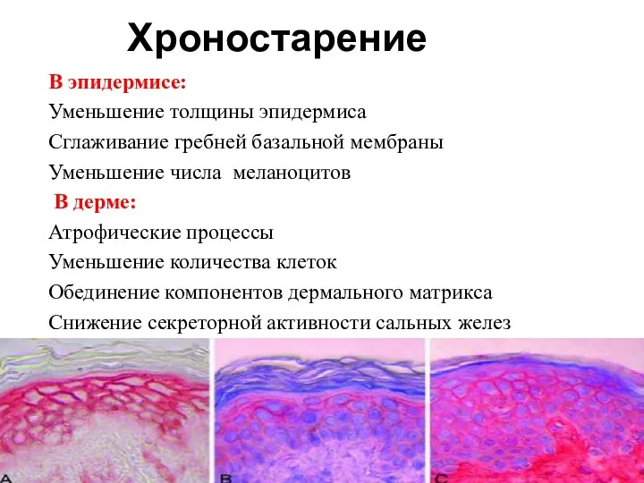 Хроностарение В эпидермисе: Уменьшение толщины эпидермиса Сглаживание гребней базальной мембраны Уменьшение
