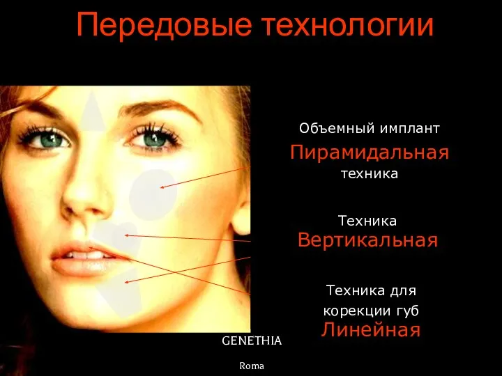 GENETHIA Roma Объемный имплант Пирамидальная техника Техника Вертикальная Техника для корекции губ Линейная Передовые технологии