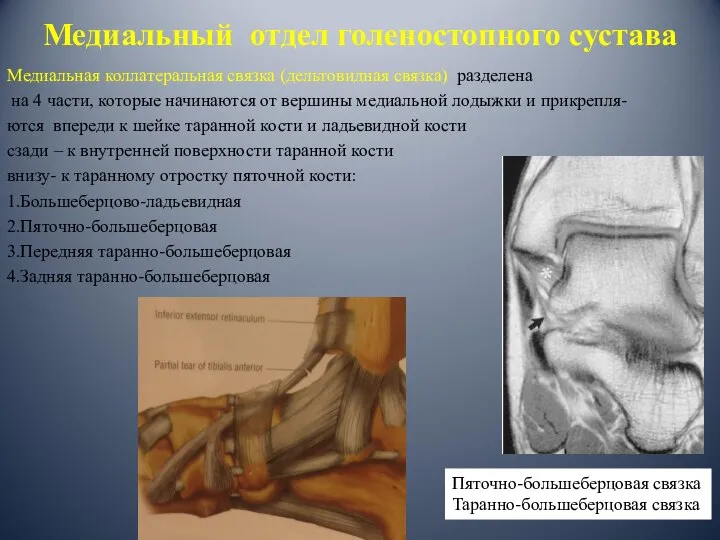 Медиальная коллатеральная связка (дельтовидная связка) разделена на 4 части, которые начинаются