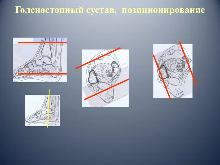 Голеностопный сустав, позиционирование