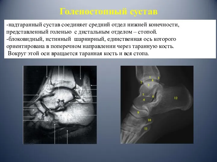 Голеностопный сустав -надтаранный сустав соединяет средний отдел нижней конечности, представленный голенью