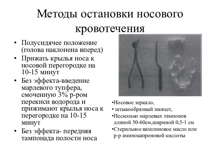 Методы остановки носового кровотечения Полусидячее положение (голова наклонена вперед) Прижать крылья