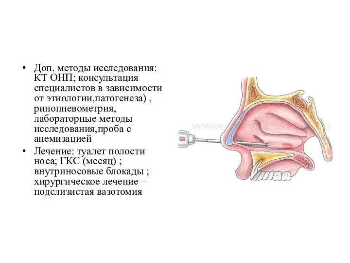 Доп. методы исследования: КТ ОНП; консультация специалистов в зависимости от этиологии,патогенеза)