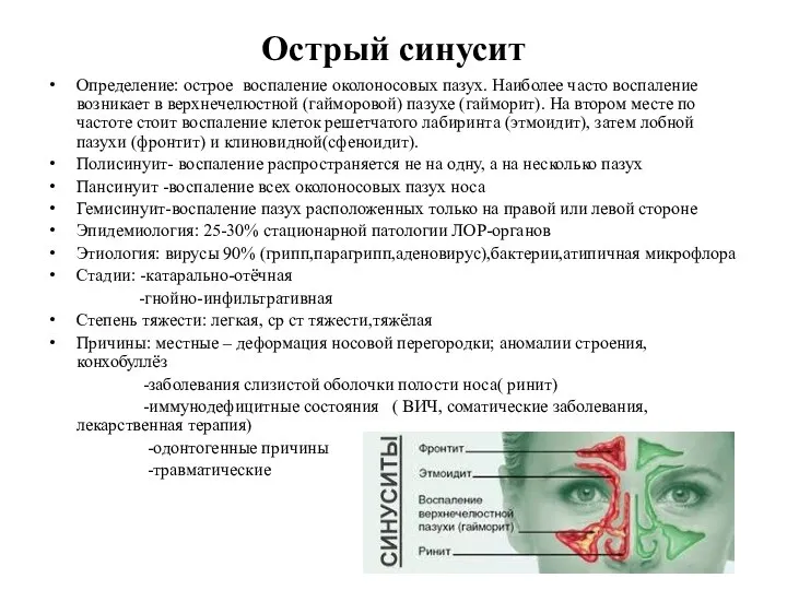 Острый синусит Определение: острое воспаление околоносовых пазух. Наиболее часто воспаление возникает