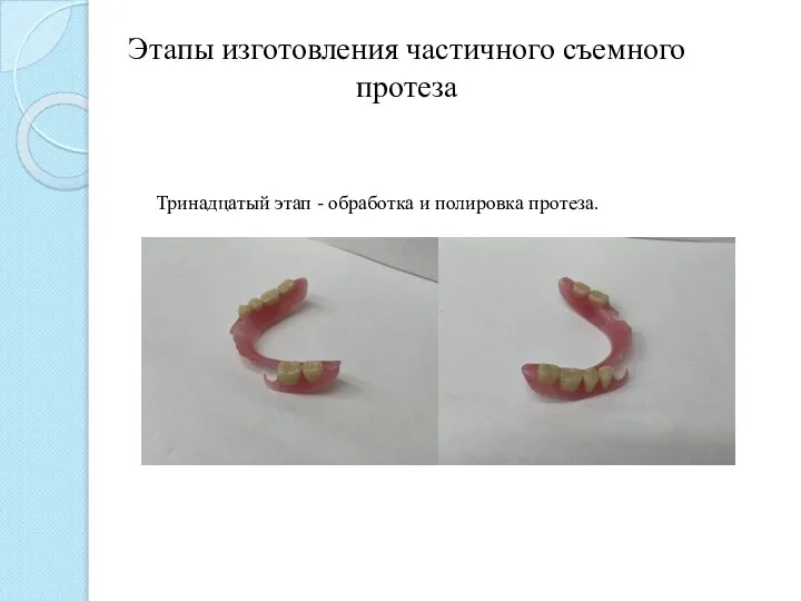 Этапы изготовления частичного съемного протеза Тринадцатый этап - обработка и полировка протеза.