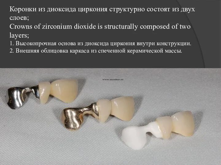 Коронки из диоксида циркония структурно состоят из двух слоев; Crowns of