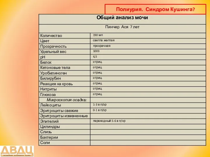 Полиурия. Синдром Кушинга?