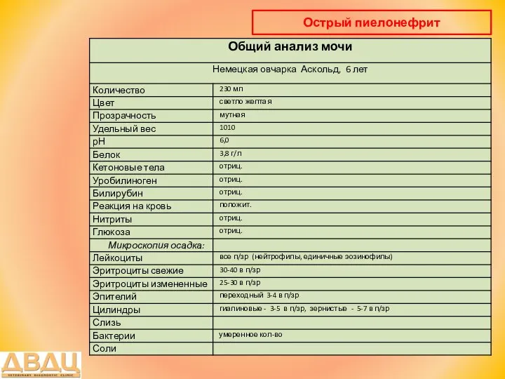 Острый пиелонефрит