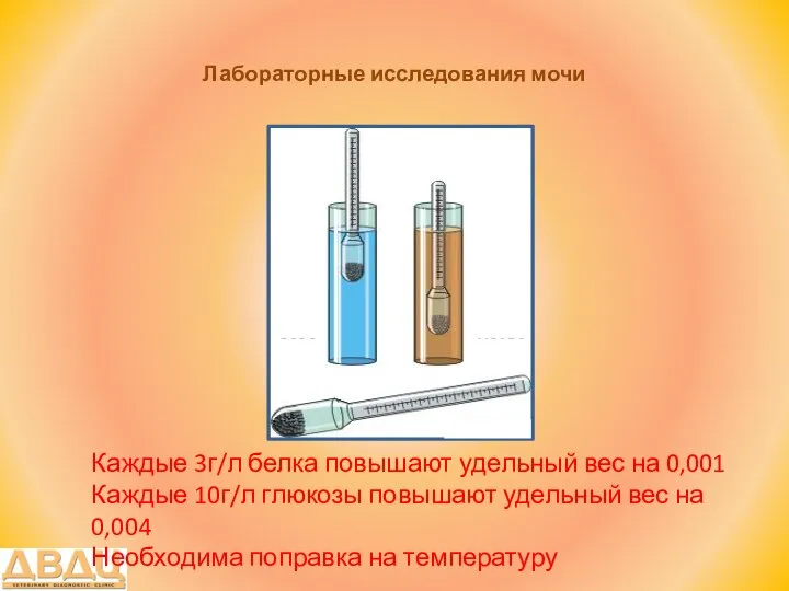 Лабораторные исследования мочи Каждые 3г/л белка повышают удельный вес на 0,001