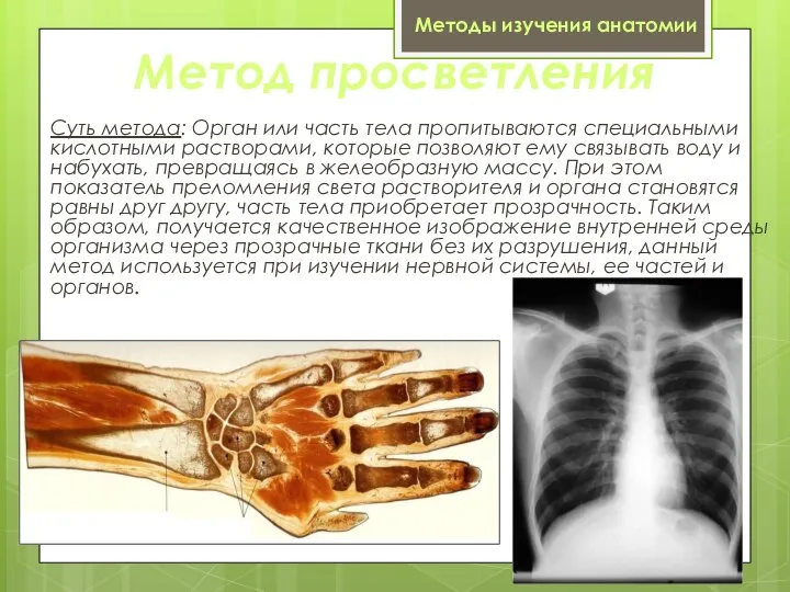 Метод просветления Суть метода: Орган или часть тела пропитываются специальными кислотными