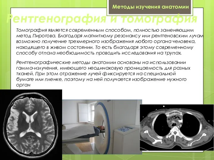 Рентгенография и томография Рентгенографические методы анатомии основаны на использовании гамма-излучения, имеющего