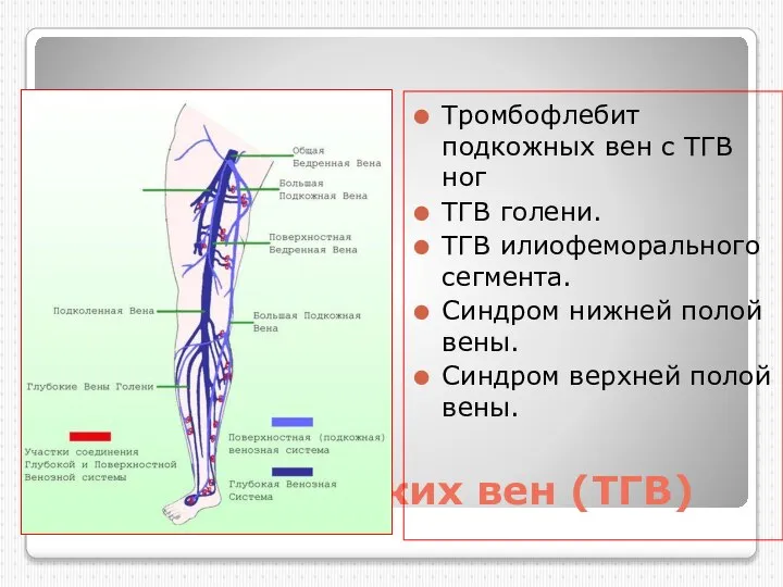 Тромбоз глубоких вен (ТГВ) Тромбофлебит подкожных вен с ТГВ ног ТГВ