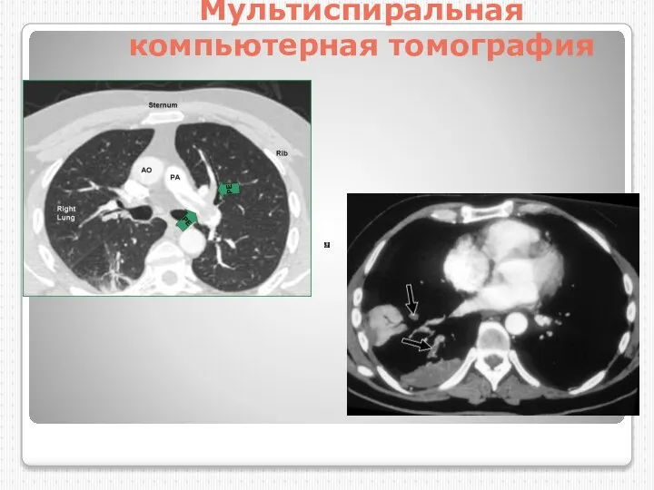 Мультиспиральная компьютерная томография