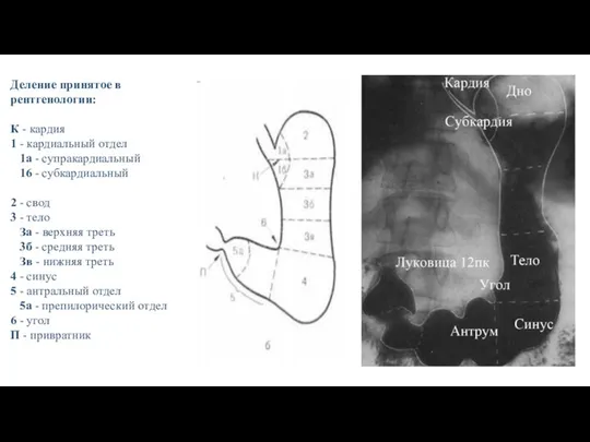 Деление принятое в рентгенологии: К - кардия 1 - кардиальный отдел