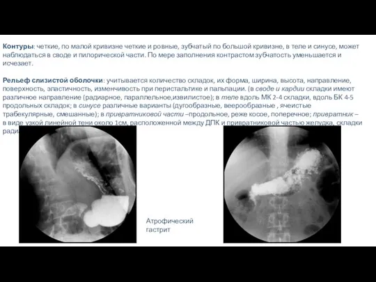 Контуры: четкие, по малой кривизне четкие и ровные, зубчатый по большой