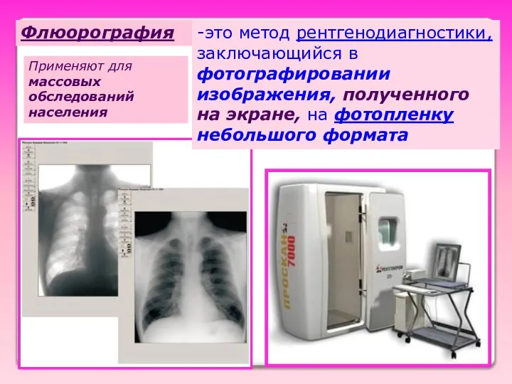 Флюорография -это метод рентгенодиагностики, заключающийся в фотографировании изображения, полученного на экране,