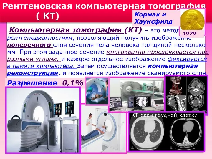Рентгеновская компьютерная томография ( КТ) Компьютерная томография (КТ) – это метод