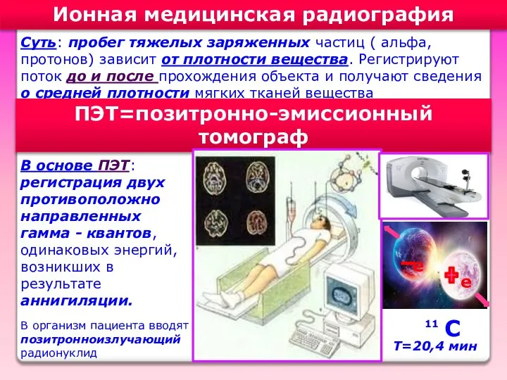 Ионная медицинская радиография Суть: пробег тяжелых заряженных частиц ( альфа, протонов)