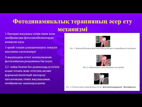 Фотодинамикалық терапияның әсер ету механизмі 1-бактерия жасушасы өзінің ішіне және мембранасына