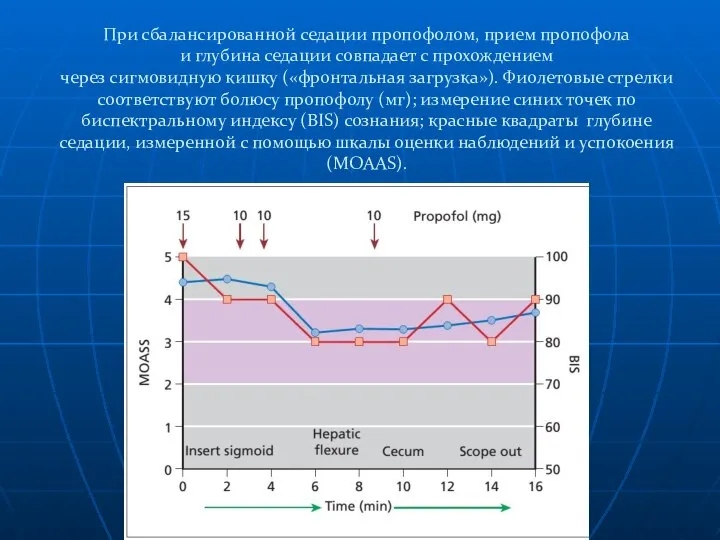 При сбалансированной седации пропофолом, прием пропофола и глубина седации совпадает с