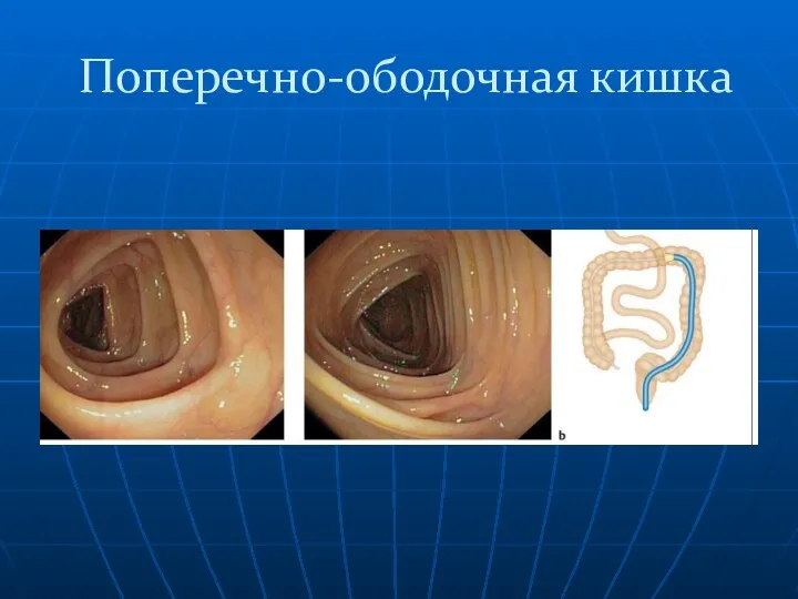 Поперечно-ободочная кишка