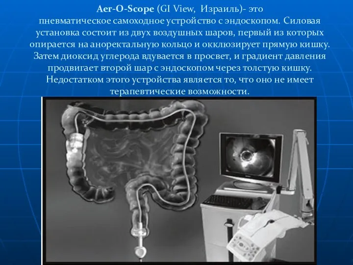 Aer-O-Scope (GI View, Израиль)- это пневматическое самоходное устройство с эндоскопом. Силовая