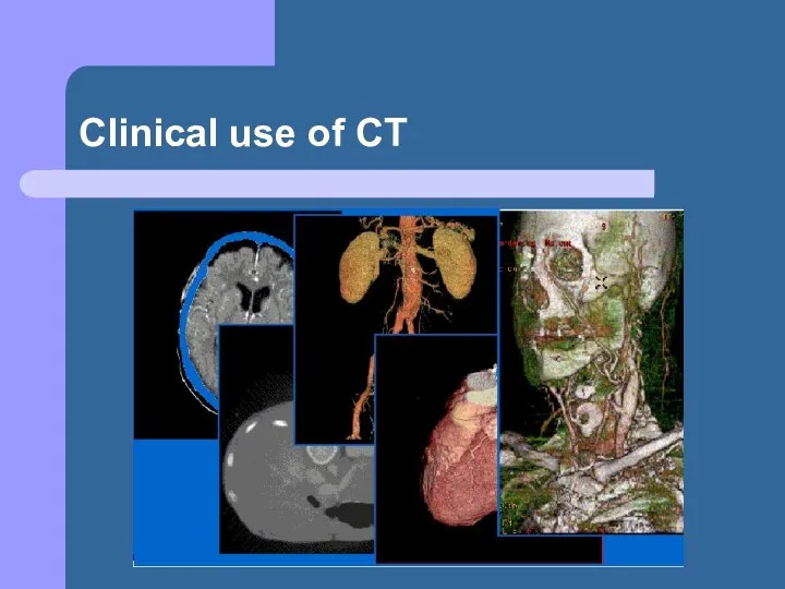 Clinical use of CT