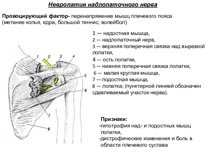 Признаки: гипотрофия над- и подостных мышц лопатки, дистрофические изменения и боль