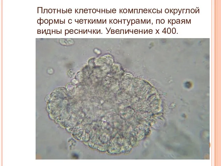 Плотные клеточные комплексы округлой формы с четкими контурами, по краям видны реснички. Увеличение х 400.