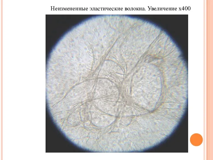 Неизмененные эластические волокна. Увеличение х400