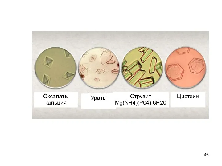 Оксалаты кальция Ураты Цистеин Струвит Mg(NH4)(P04)-6H20