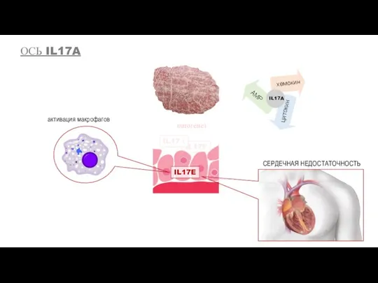 IL17F хемокин AMP цитокин IL17A IL17E IL17А патогенез активация макрофагов СЕРДЕЧНАЯ НЕДОСТАТОЧНОСТЬ ОСЬ IL17A
