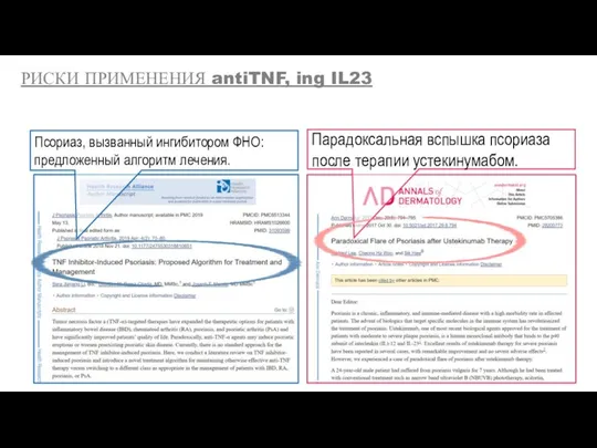 Парадоксальная вспышка псориаза после терапии устекинумабом. Псориаз, вызванный ингибитором ФНО: предложенный